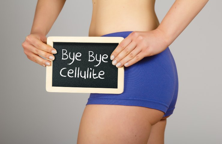 cellulite cause